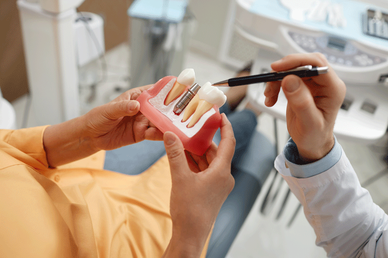 Woman holding tooth model during consultation on dental implant